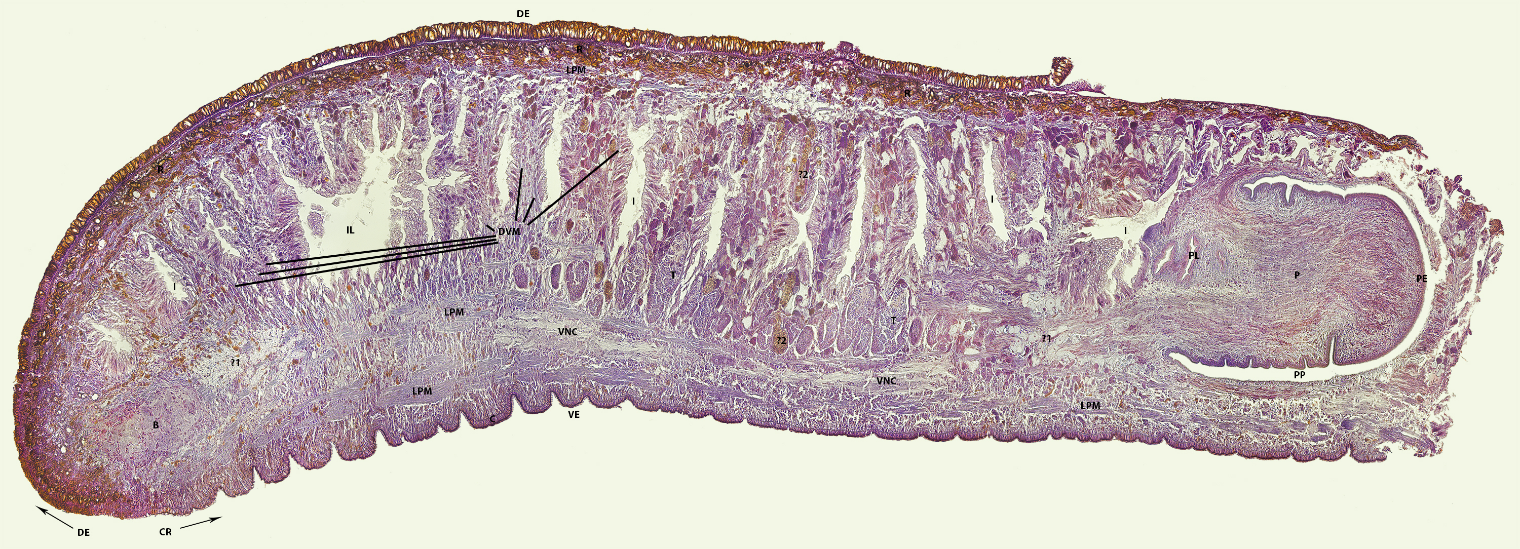 Microplana terrestris